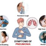 Can Viral Pneumonia Treatments Reduce Long-Term Complications