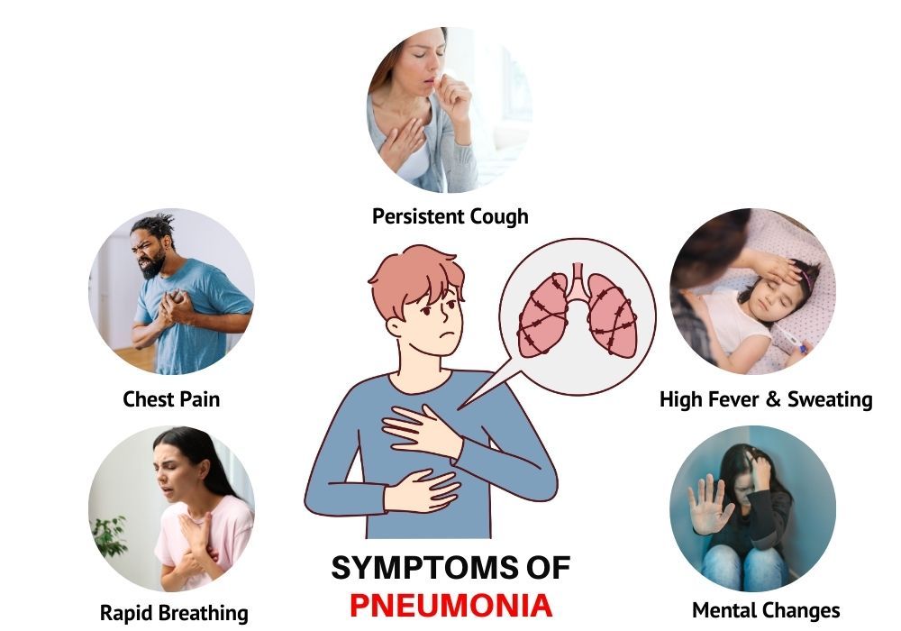 Can Viral Pneumonia Treatments Reduce Long-Term Complications