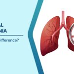 When Viral Pneumonia Treatments Work Better Than Antibiotics