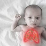 When Viral Pneumonia Treatments Should Be Started