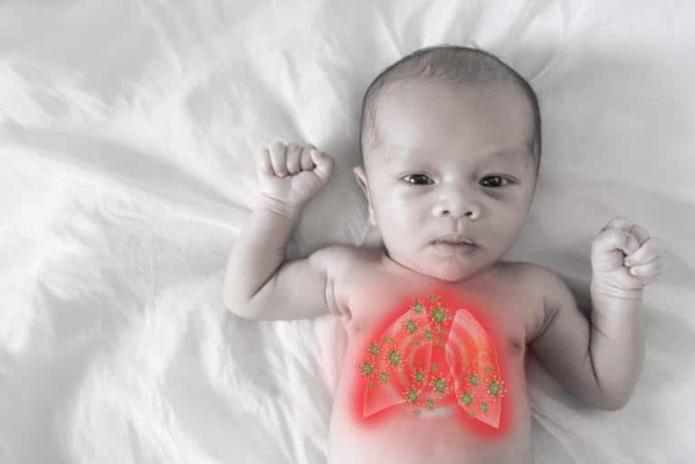 When Viral Pneumonia Treatments Should Be Started